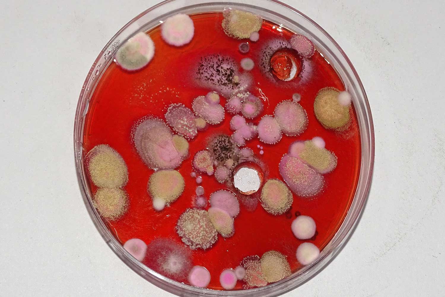 Microbial